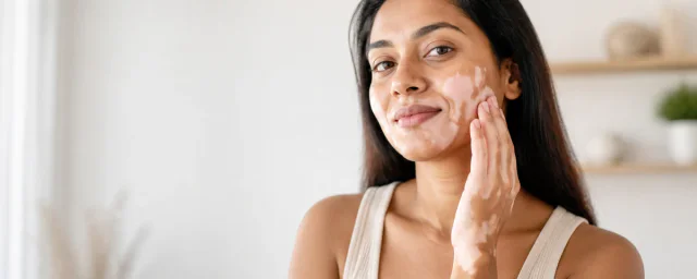 Vitiligo & Depigmentation Care care at 800 Pharmacy